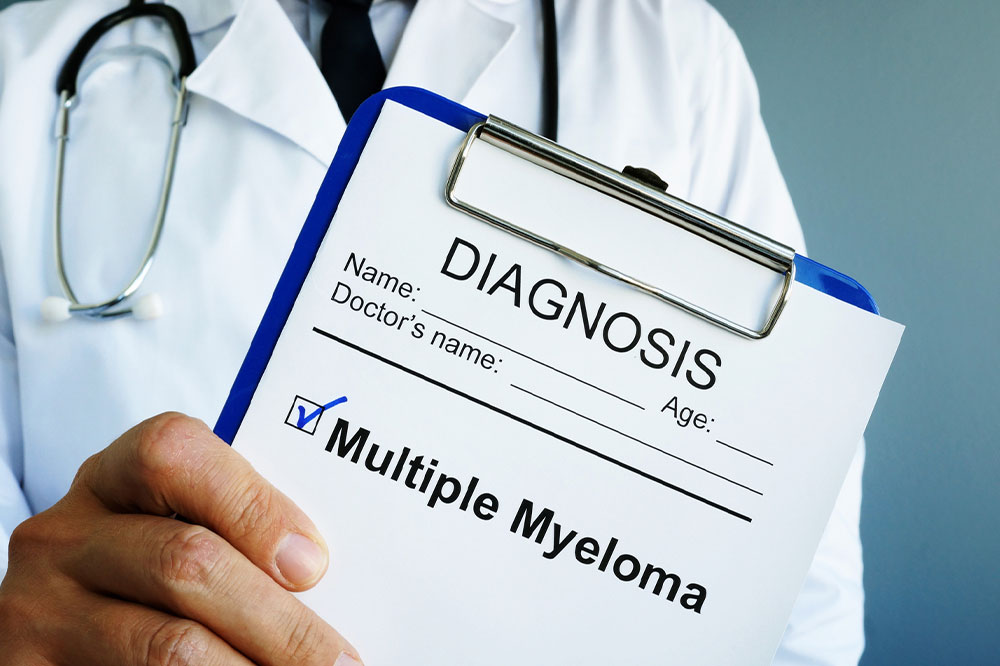 4 early signs of multiple myeloma