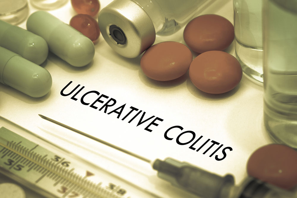 5 Common Causes of Colitis