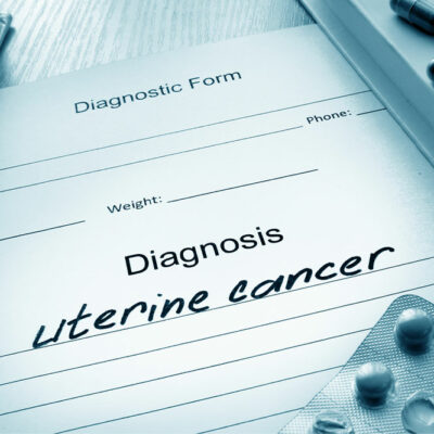 Causes and symptoms of uterine cancer