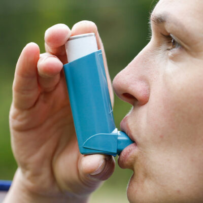 Causes, treatment, and preventive measures of asthma