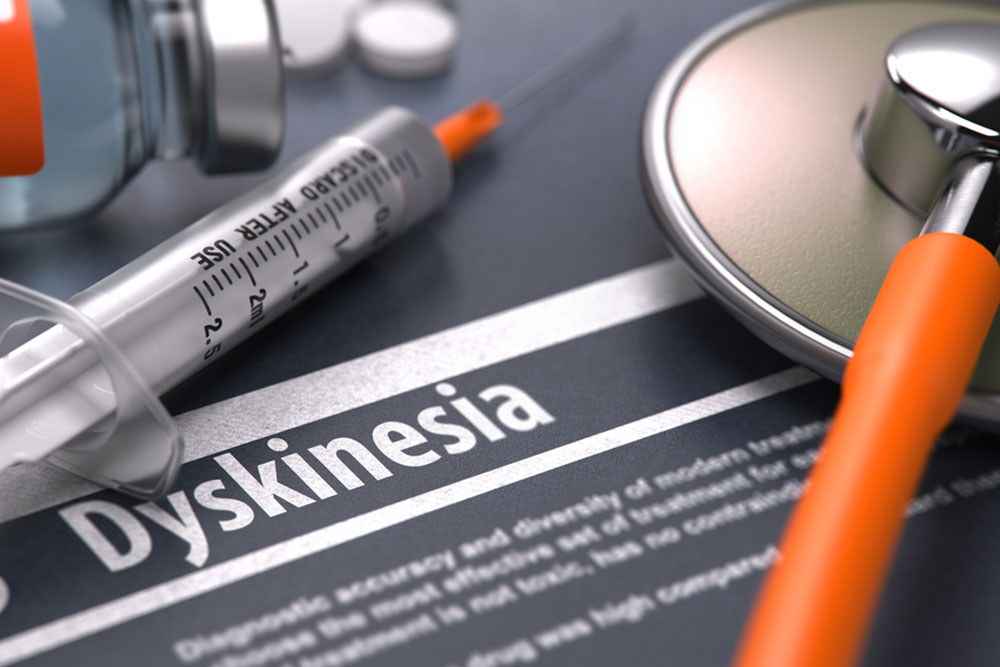 An overview of the symptoms and causes of dyskinesia