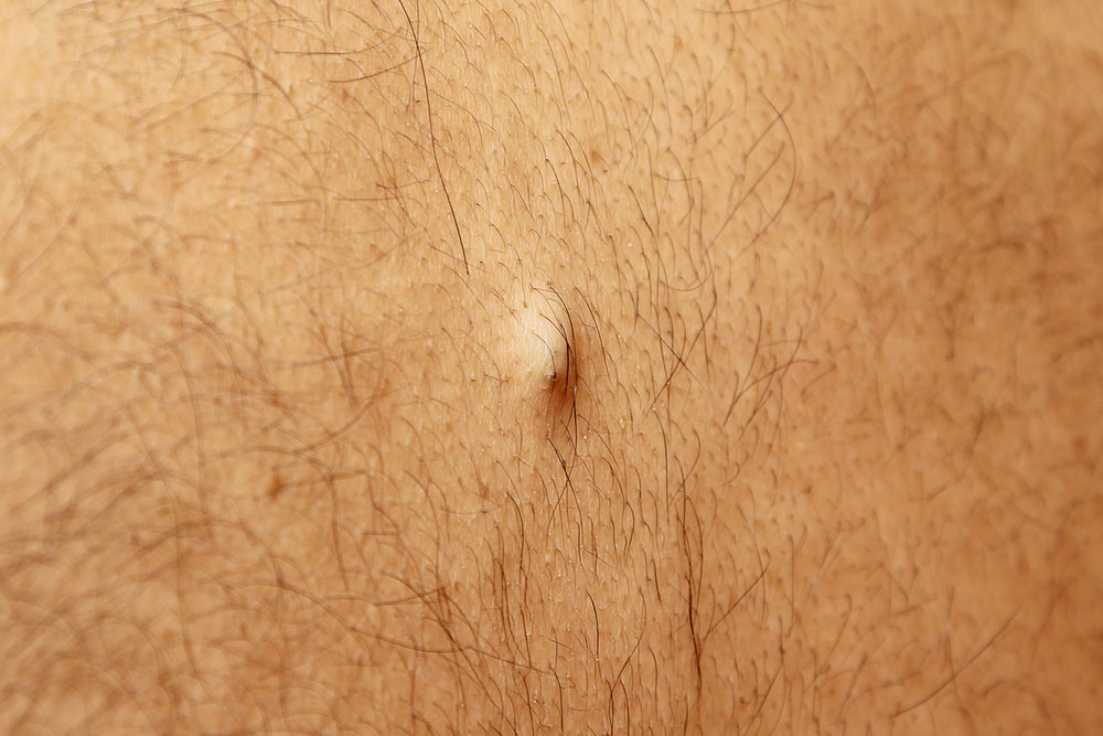 Facts and Signs of Ingrown Hair