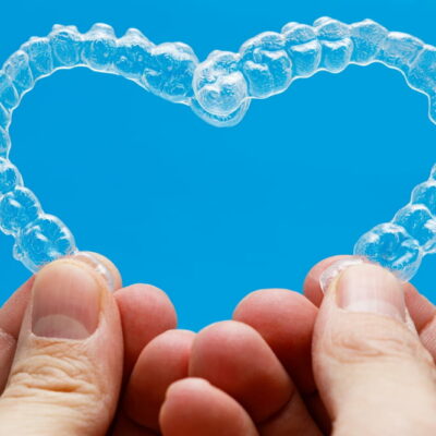 Key factors to know about invisible dental aligners