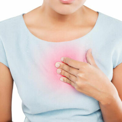 How to Treat and Prevent Heartburn and Indigestion