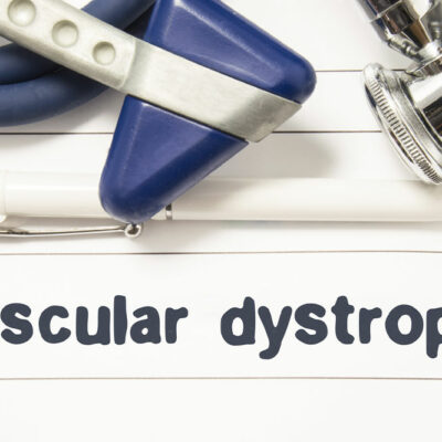 Muscular dystrophy Symptoms, causes, and management options