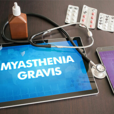 Myasthenia gravis &#8211; 5 common symptoms